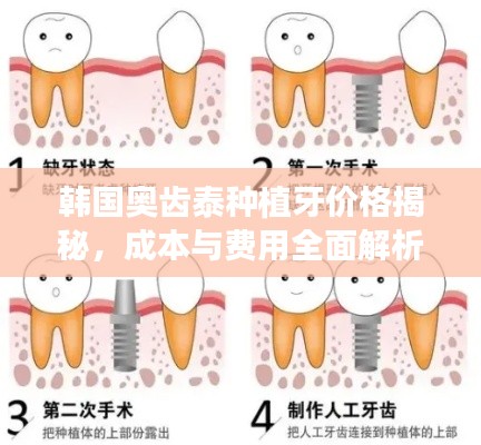 韩国奥齿泰种植牙价格揭秘，成本与费用全面解析
