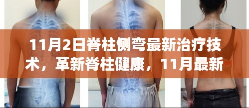 革新脊柱健康，最新脊柱侧弯治疗技术解析（11月版）