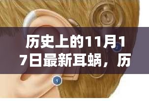 历史上的11月17日，耳蜗学习指南——从入门到精通