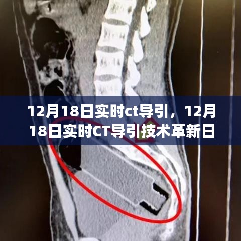 12月18日实时CT导引技术革新日，背景、进展与深远影响的回顾