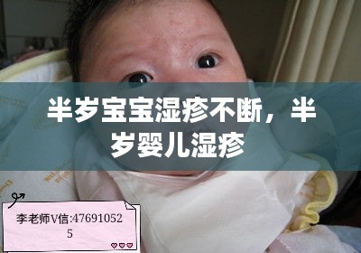 半岁宝宝湿疹不断，半岁婴儿湿疹 