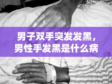 男子双手突发发黑，男性手发黑是什么病症 